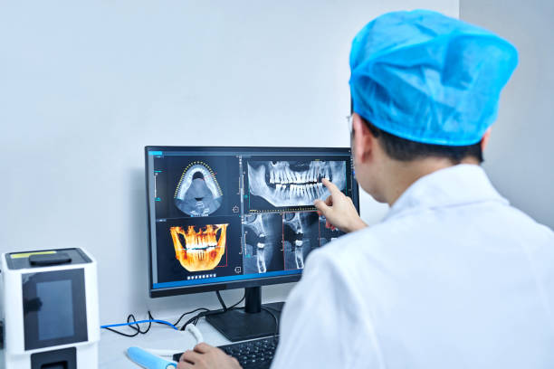Best Emergency Dentist for Lost Fillings or Crowns in Lewisburg, PA